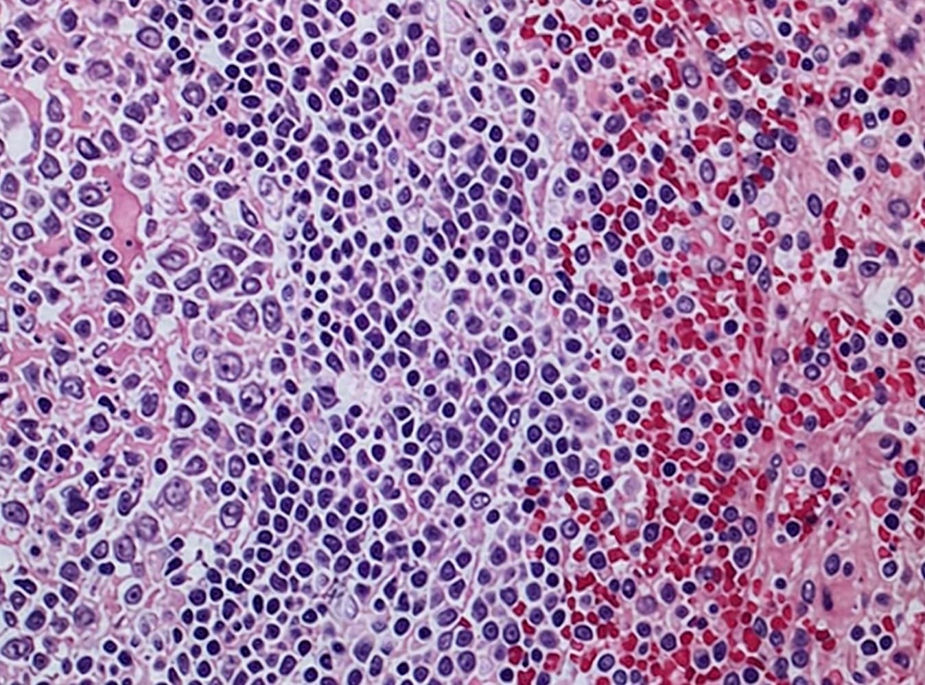 B Cell
