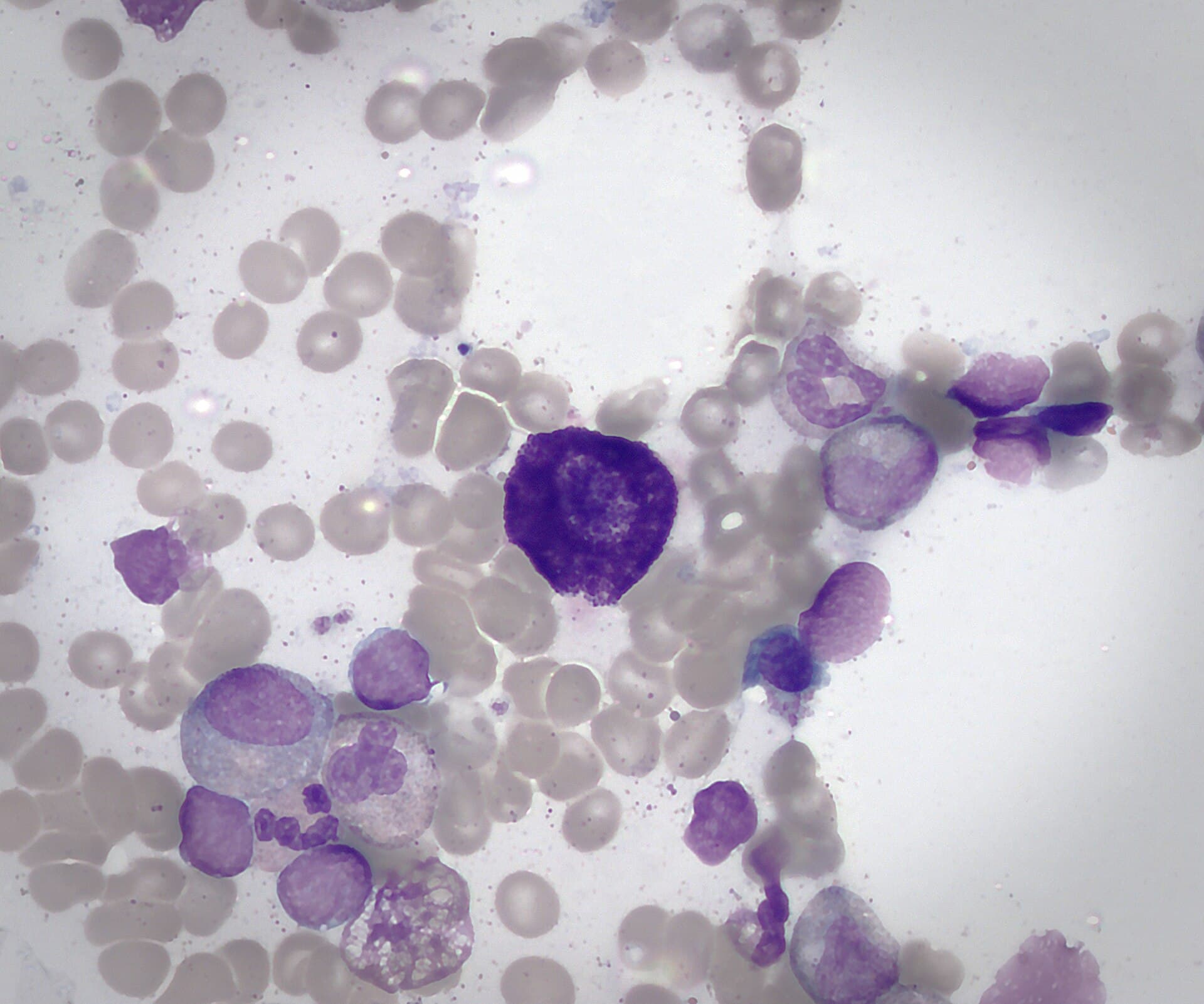 Mast Cell