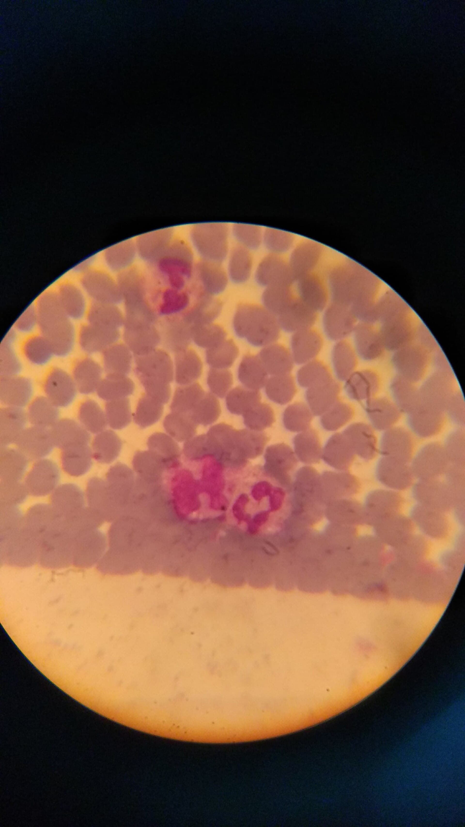 Monocyte