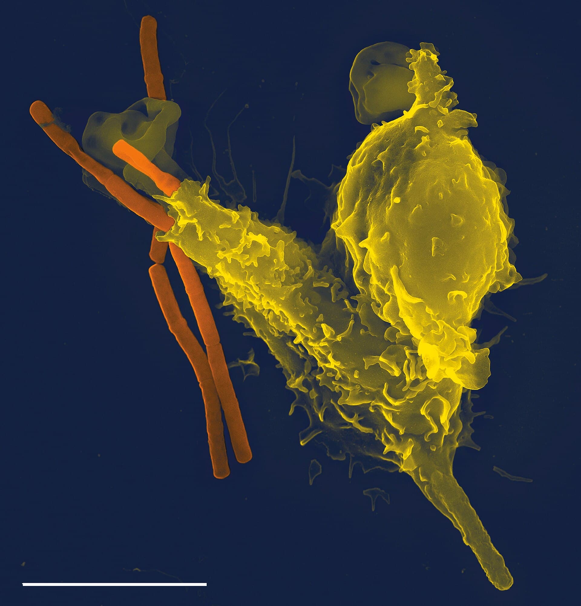 Neutrophil
