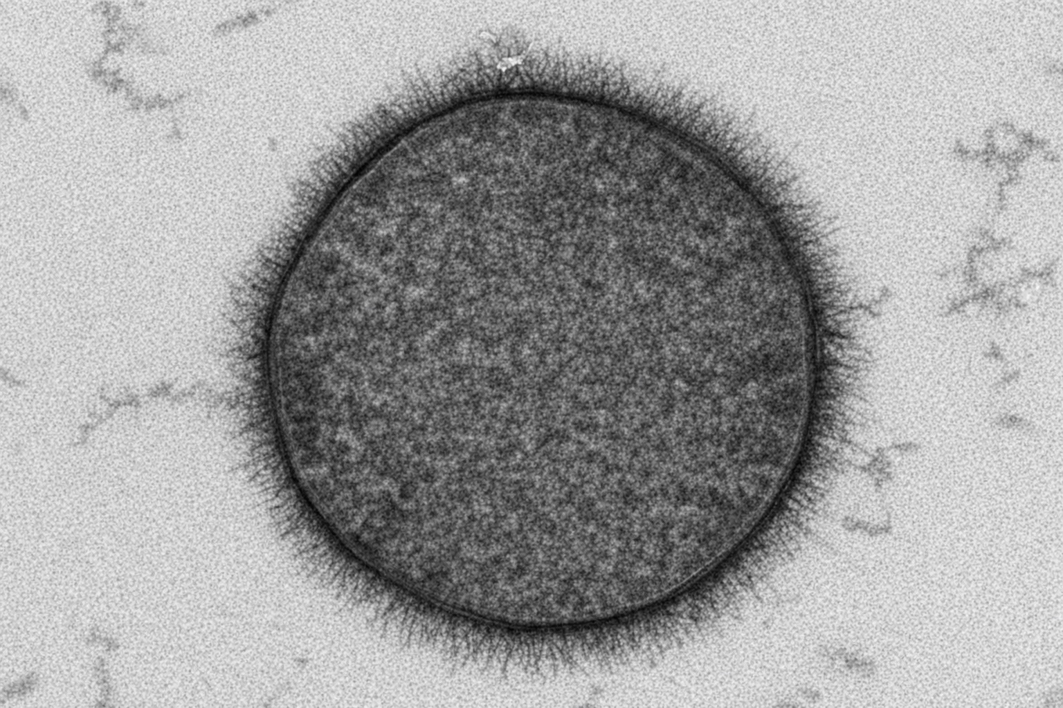 Cell glycocalyx under electron microscopy